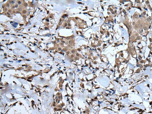 UBA52 Polyclonal Antibody - image 1