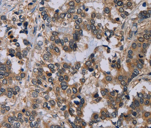NECTIN4 Polyclonal Antibody - image 1