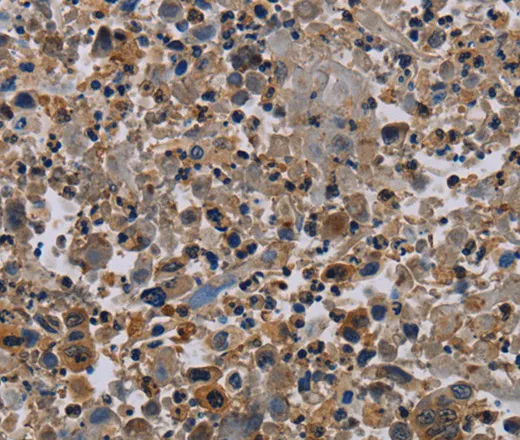 NECTIN4 Polyclonal Antibody - image 2