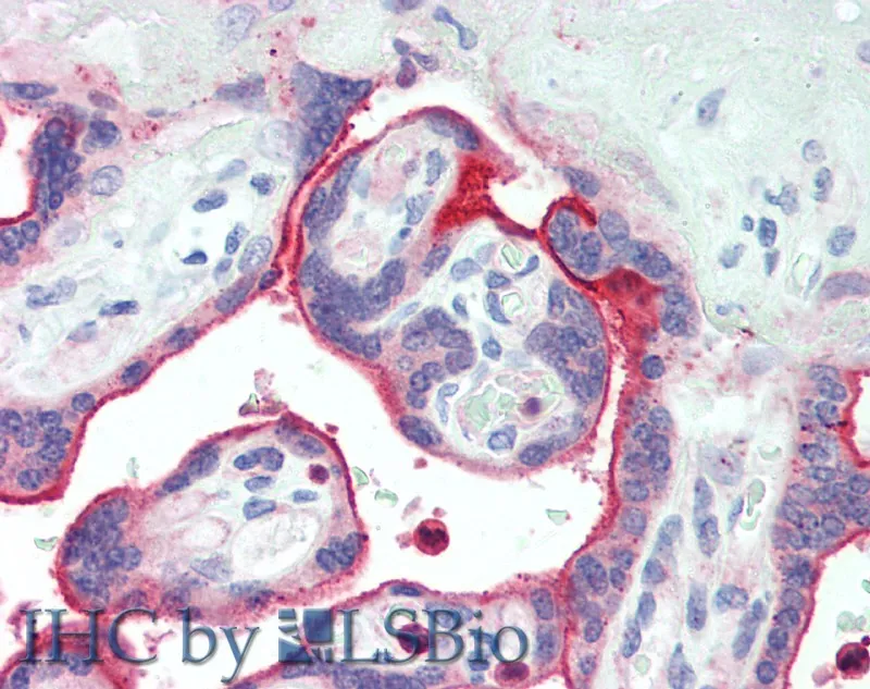 NECTIN4 Polyclonal Antibody - image 3