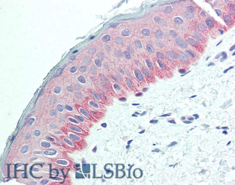 NECTIN4 Polyclonal Antibody - image 4