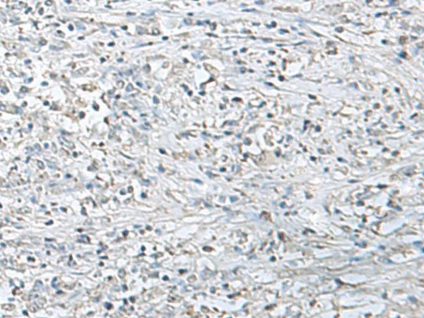 EPM2A Polyclonal Antibody - image 1