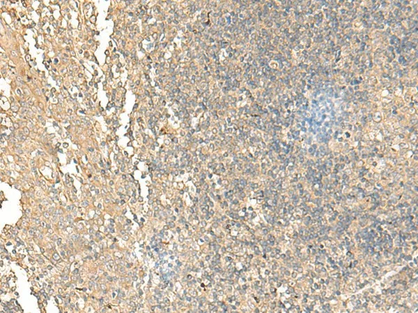 NARS Polyclonal Antibody - image 1