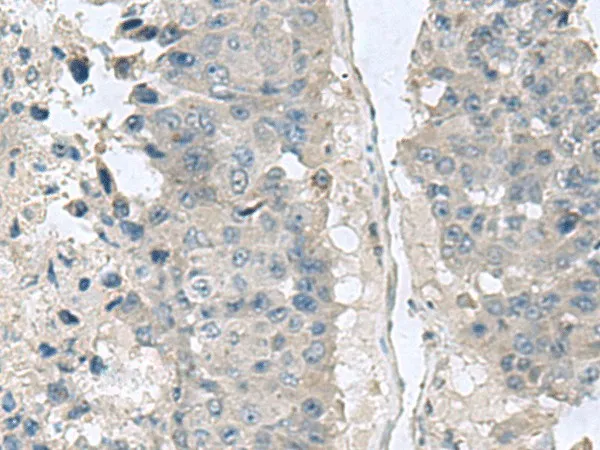 NPHP1 Polyclonal Antibody - image 1