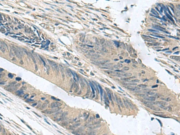 NPHP1 Polyclonal Antibody - image 2