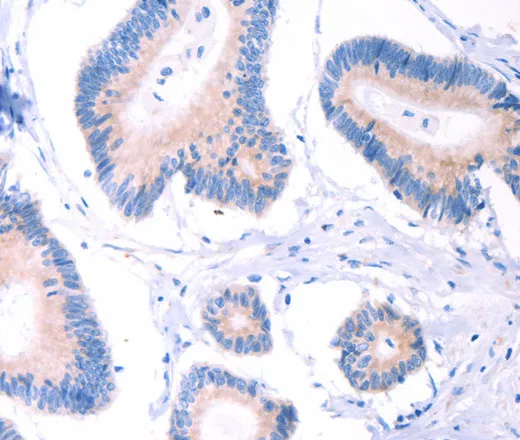 AADAC Polyclonal Antibody - image 1