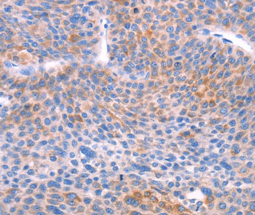 AADAC Polyclonal Antibody - image 2