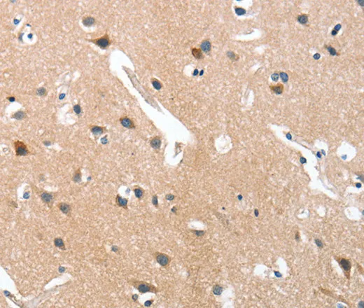 GRB7 Polyclonal Antibody - image 1