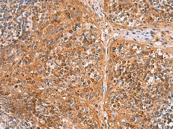 CREBBP Polyclonal Antibody - image 1