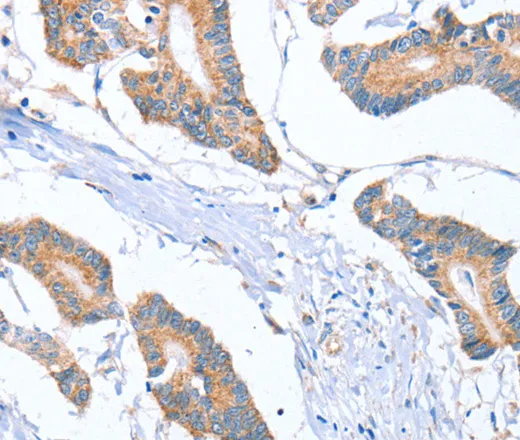 MTMR7 Polyclonal Antibody - image 1