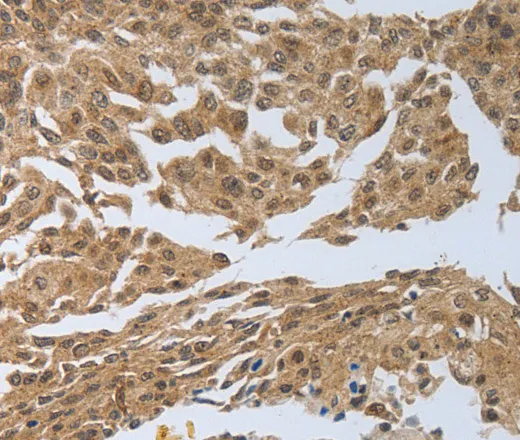 PSMD6 Polyclonal Antibody - image 1