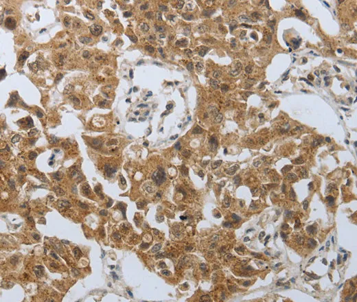 PSMD6 Polyclonal Antibody - image 2