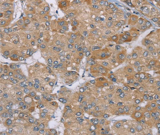 ACTN2 Polyclonal Antibody - image 1