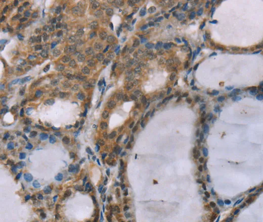 ACTN2 Polyclonal Antibody - image 2