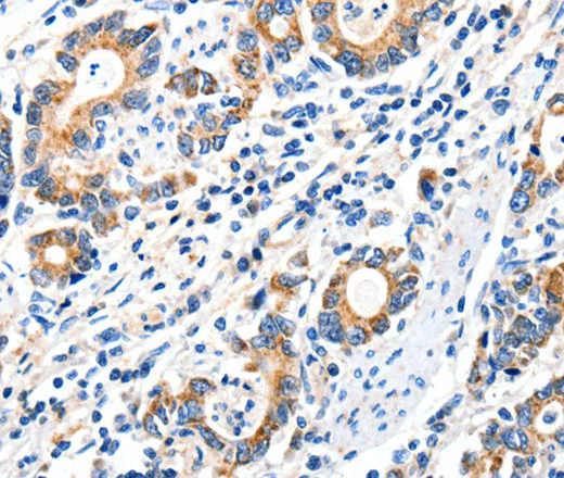 GluR2 Polyclonal Antibody - image 1