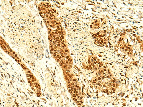 UNKL Polyclonal Antibody - image 1