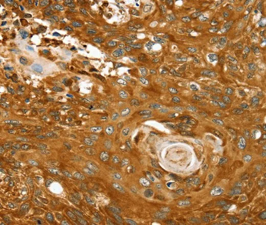 ABCC8 Polyclonal Antibody - image 1