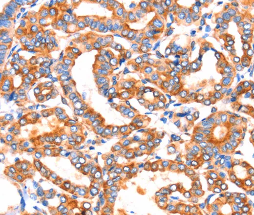 SEPT4 Polyclonal Antibody - image 1