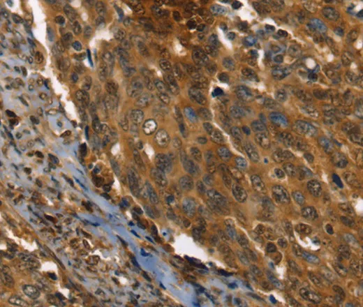 PPIA Polyclonal Antibody - image 1