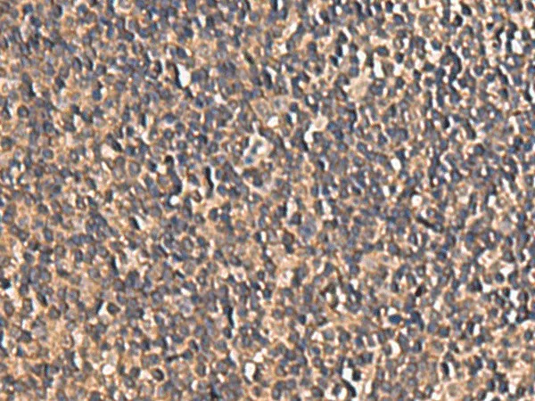 PLEKHF2 Polyclonal Antibody - image 1