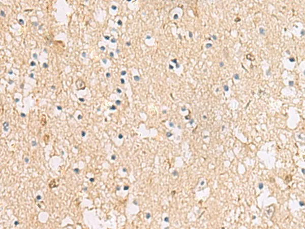PLEKHF2 Polyclonal Antibody - image 2