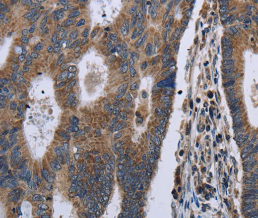GSTA3 Polyclonal Antibody - image 1