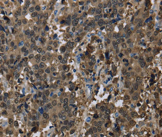 GSTA3 Polyclonal Antibody - image 2
