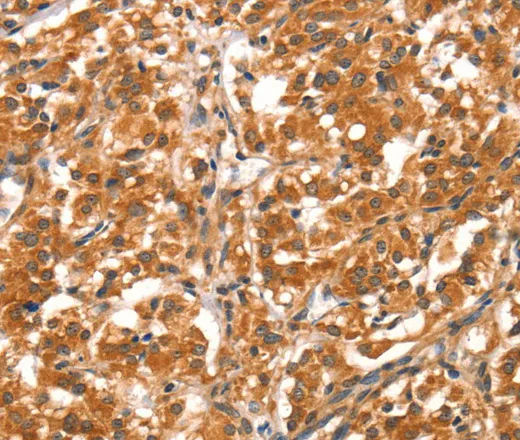 DAB2IP Polyclonal Antibody - image 1