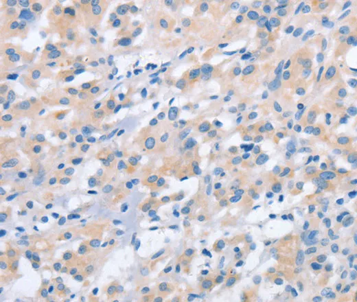 NCAPD2 Polyclonal Antibody - image 1