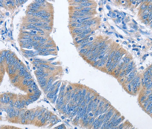 NCAPD2 Polyclonal Antibody - image 2