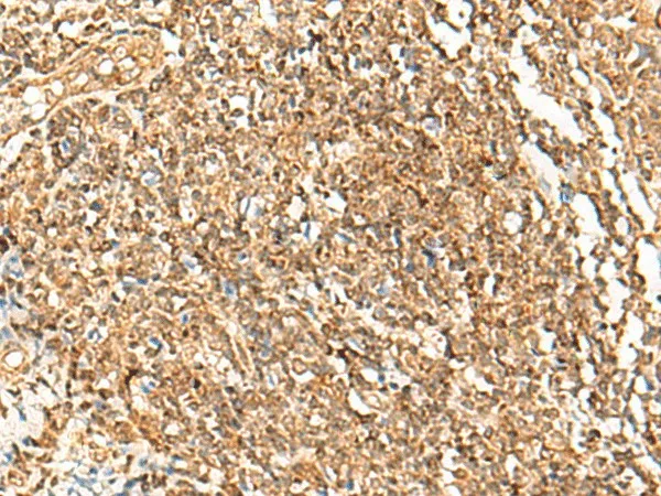 POLH Polyclonal Antibody - image 1
