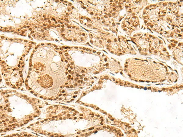 POLH Polyclonal Antibody - image 2