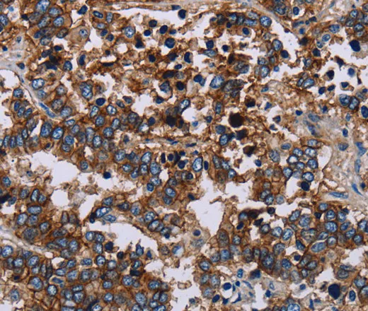 JAM-A Polyclonal Antibody - image 1