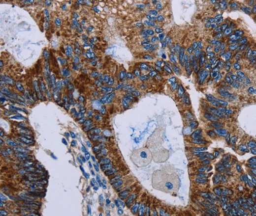 JAM-A Polyclonal Antibody - image 2