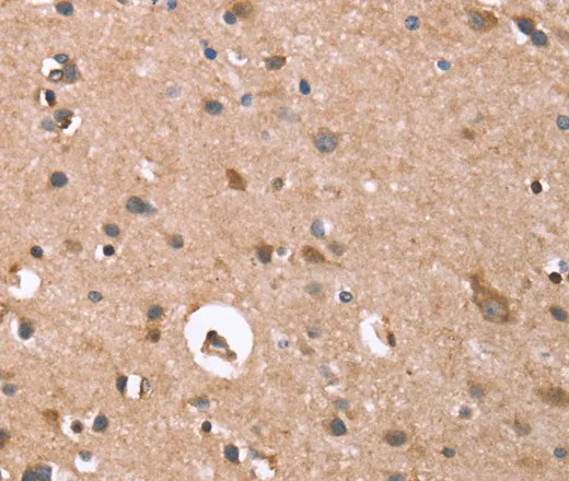 GPC6 Polyclonal Antibody - image 2