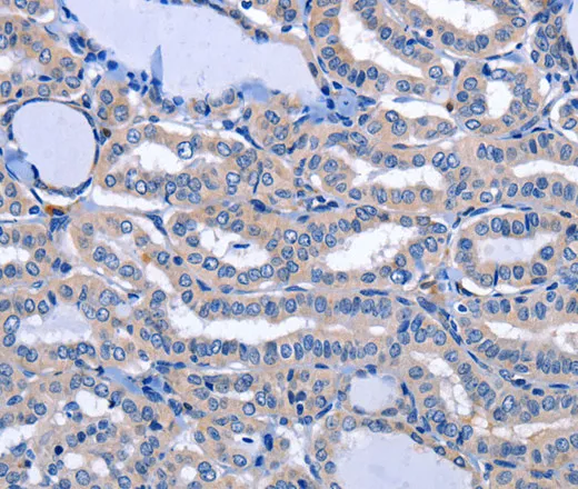 NPPB Polyclonal Antibody - image 1