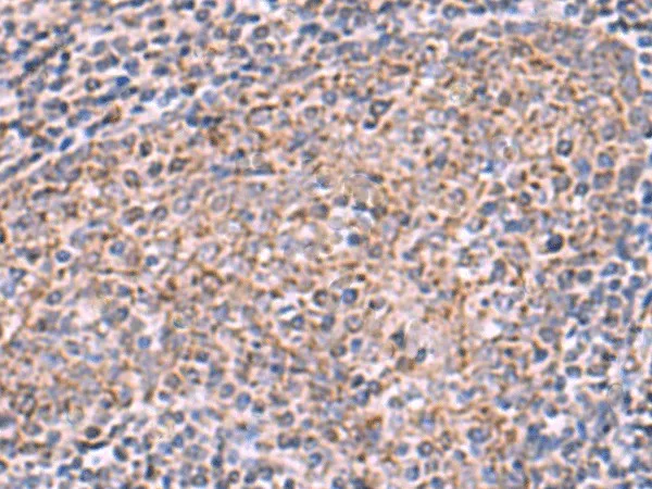 ECSIT Polyclonal Antibody - image 1