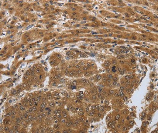 PSMD6 Polyclonal Antibody - image 1