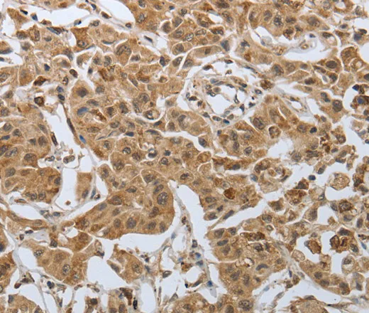 PSMD6 Polyclonal Antibody - image 2