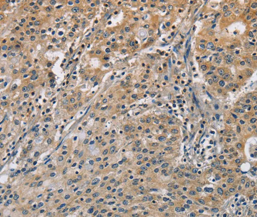 DNMT3A Polyclonal Antibody - image 1
