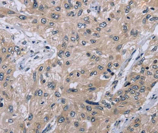 EID1 Polyclonal Antibody - image 1