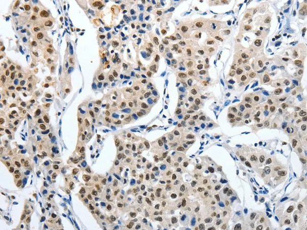 MAGEA6 Polyclonal Antibody - image 1