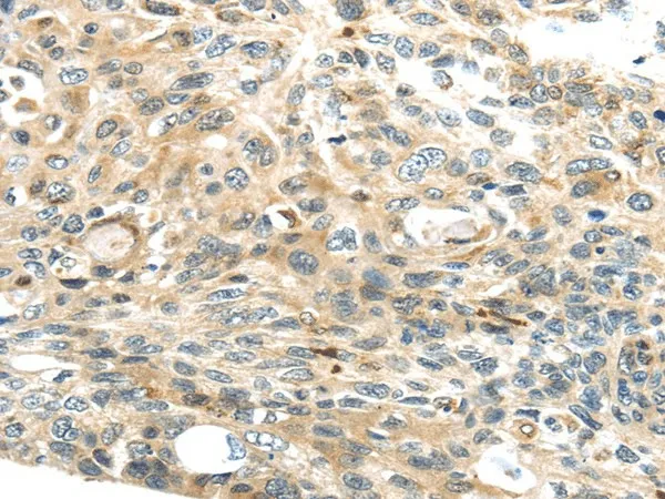 TMPRSS4 Polyclonal Antibody - image 1