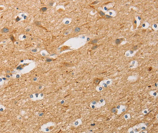 ATG4D Polyclonal Antibody - image 1