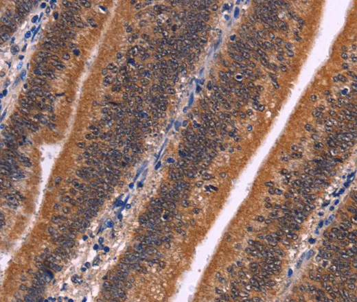 CDC5L Polyclonal Antibody - image 1