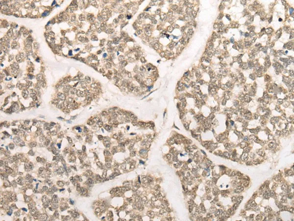 CAPN15 Polyclonal Antibody - image 1