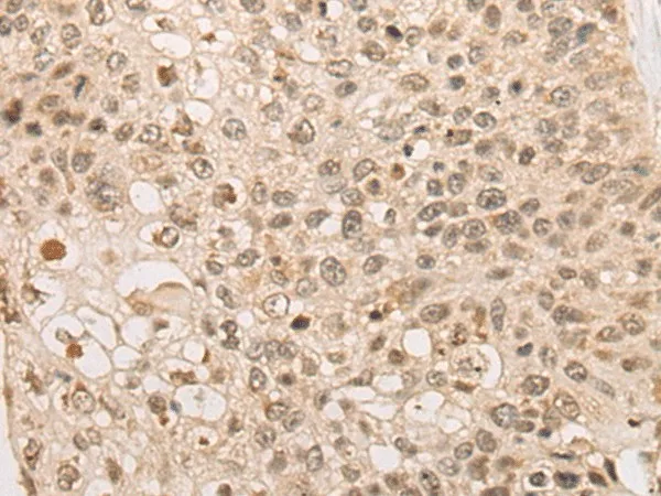 CAPN15 Polyclonal Antibody - image 2
