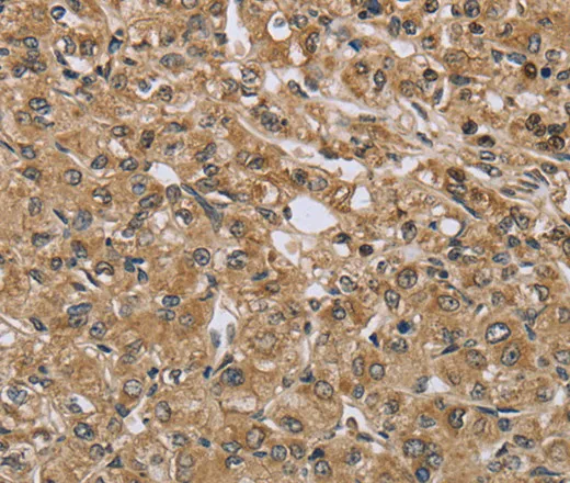 TXLNA Polyclonal Antibody - image 1