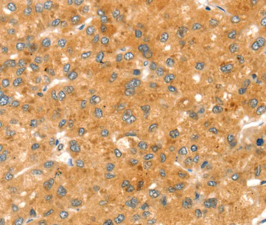 RAB27A Polyclonal Antibody - image 1