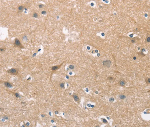 CDC25B Polyclonal Antibody - image 1
